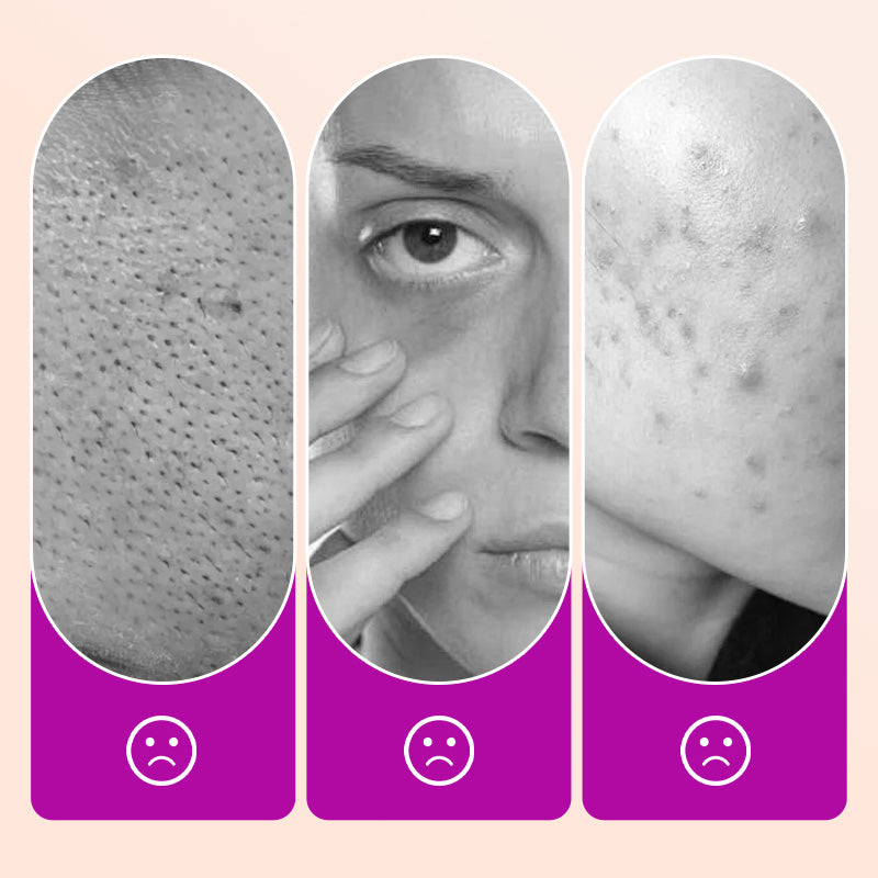 💖Köp 1 få 1 gratis🌸Soft Matte Cream Concealer