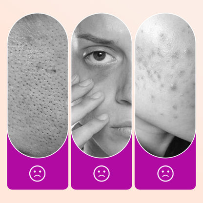 💖Köp 1 få 1 gratis🌸Soft Matte Cream Concealer